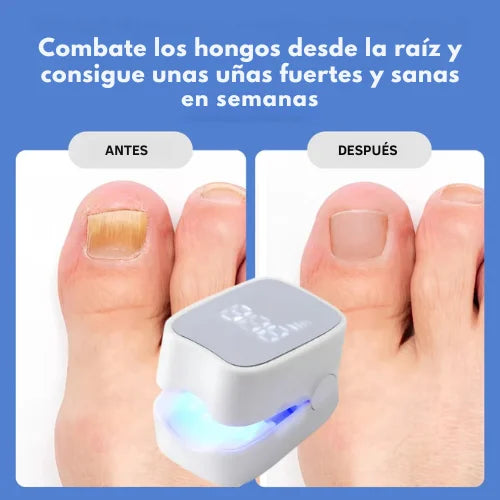 NailPure™